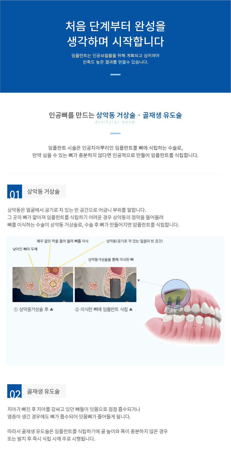 인공뼈를-만드는-상악동-거상술,골재생-유도술 임플란트-시술은-인공치아뿌리인-임플란트를-뼈에-식립하는-수술로, 만약-심을-수-있는-뼈가-충분하지-않다면-인공적으로-만들어-임플란트를-식립합니다.