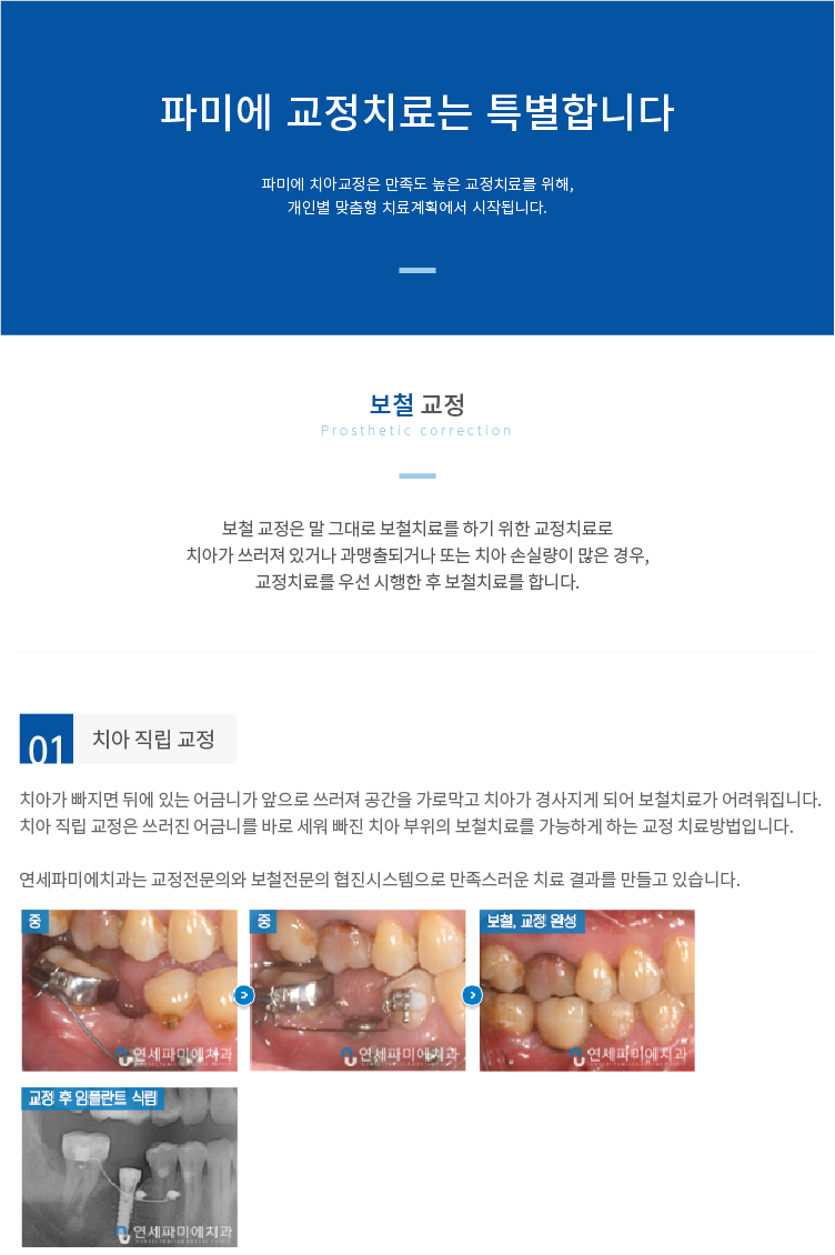 보철-교정 치아-직립-교정