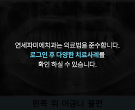 연세파미에치과는-의료법을-준수합니다. 로그인-후-다양한-치료사례를-확인-하실-수-있습니다.
