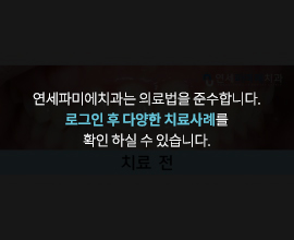 연세파미에치과는-의료법을-준수합니다. 로그인-후-다양한-치료사례를-확인-하실-수-있습니다.