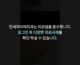 연세파미에치과는-의료법을-준수합니다. 로그인-후-다양한-치료사례를-확인-하실-수-있습니다.